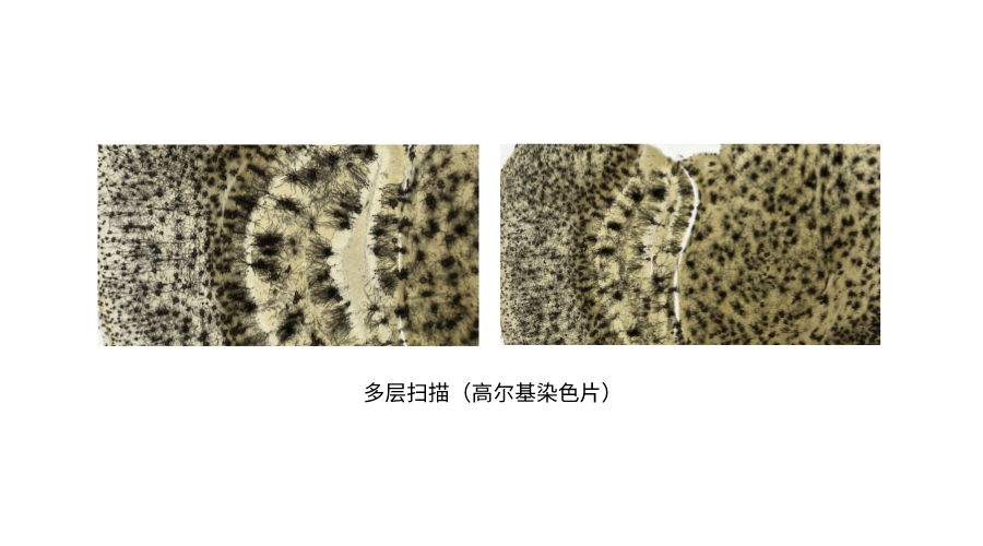多层扫描（高尔基染色片） (2).png