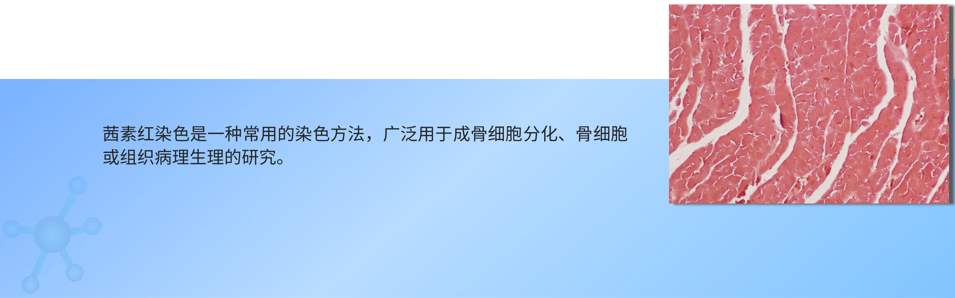 1691485777156628.png 茜素红染色 (1).png